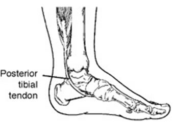 Posterior tibial tendon